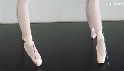 What is Sickle Feet in Dance? Exploring the Curves and Contours of Movement